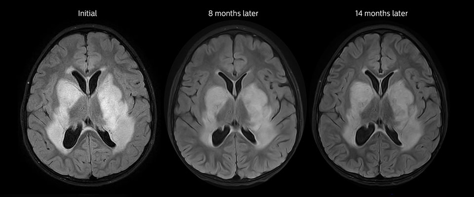 Ergebnisse der Nachuntersuchung