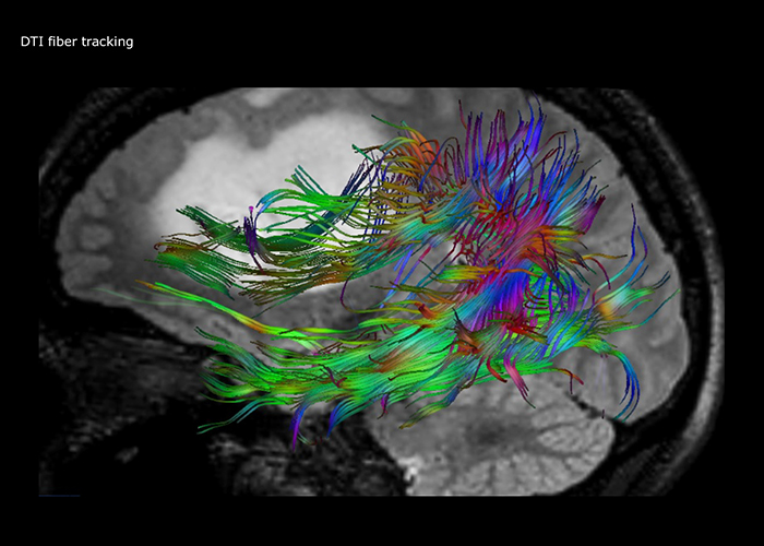 ein buntes Bild eines Vogels