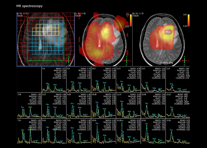 eine Nahaufnahme eines Gehirnscans