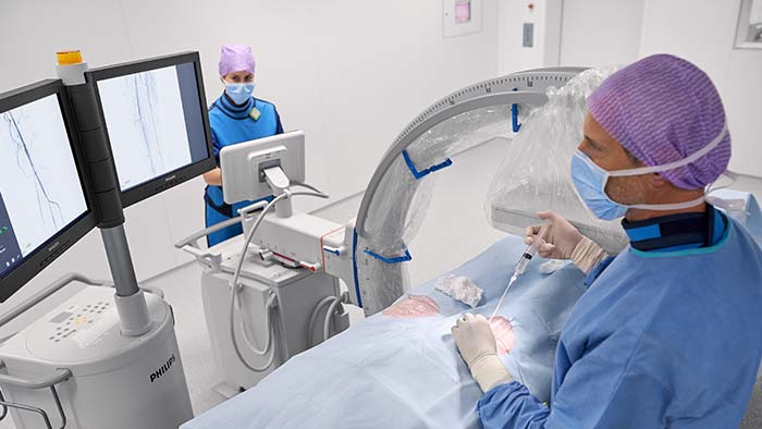 Mobile C-Bögen für die Gefäßdiagnostik