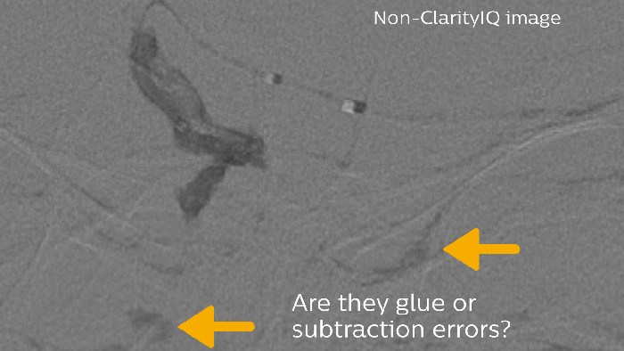 Klebstoff und Subtraktionsartefakte