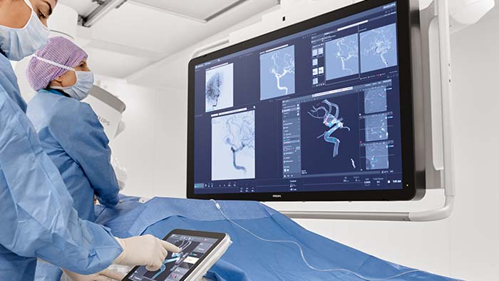 Behandlung von zerebralen Aneurysmen