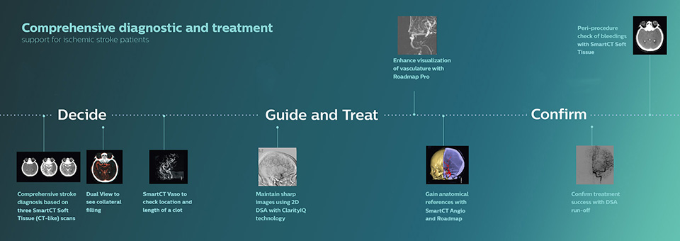 ein Diagramm eines medizinischen Verfahrens