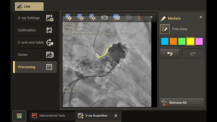 Azurion L&ouml;sungen f&uuml;r den Arbeitsablauf