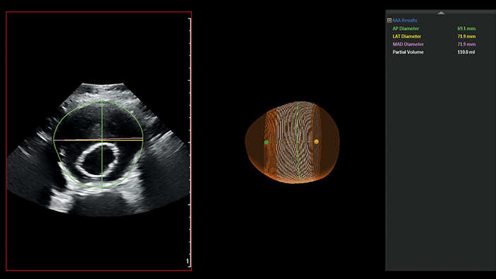 Klinisches Ultraschallbild