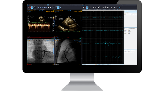 Benutzeroberfl&auml;che des Kardiologiemoduls auf einem Monitor