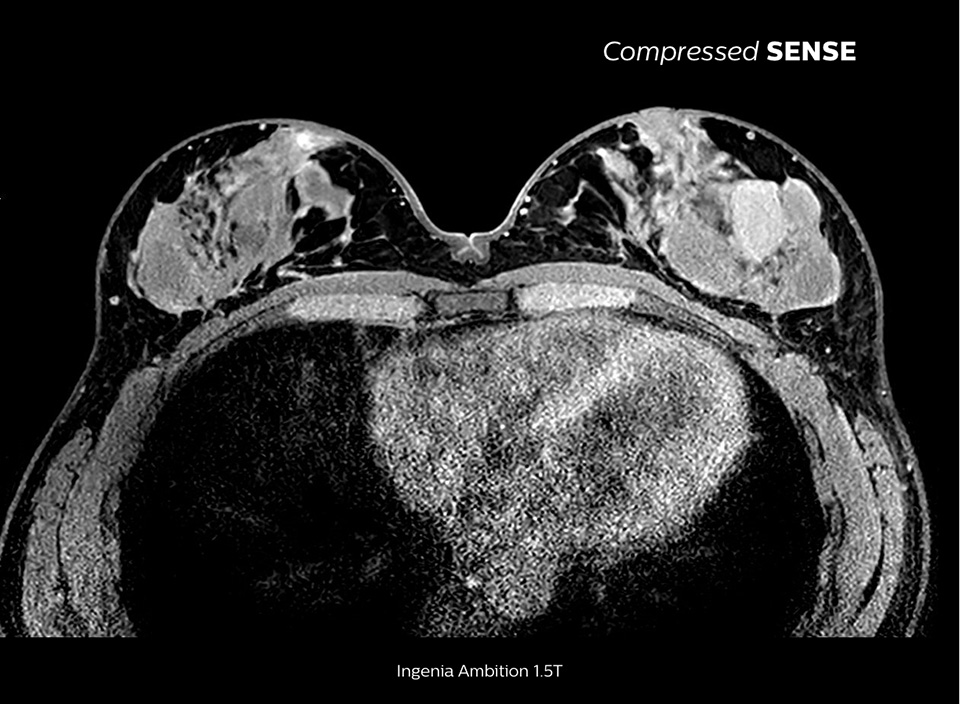 Vollst&auml;ndige Untersuchung 1:55&nbsp;Minuten