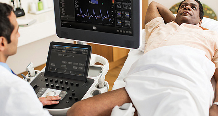 Modernes Ultraschallger&auml;t Philips EPIQ