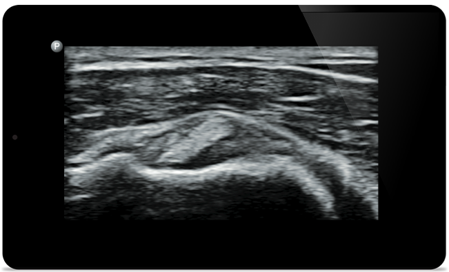 Die Behandlung beginnt mit einer pr&auml;zisen Diagnose