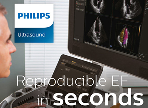 Reproducible EF in seconds&nbsp;&ndash; Philips EPIQ&nbsp;7 HeartModelᴬ&sdot;ᴵ&sdot; (Reproduzierbare EF innerhalb von Sekunden&nbsp;&ndash; Philips EPIQ&nbsp;7 HeartModelᴬ&sdot;ᴵ&sdot;)