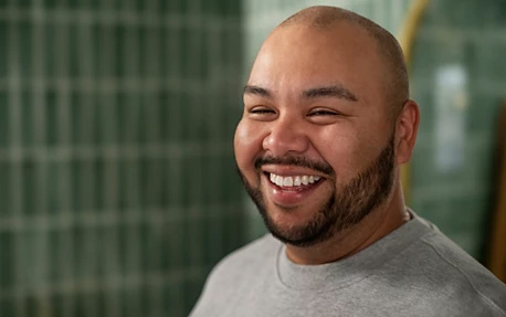 Haarausfall bei M&auml;nnern