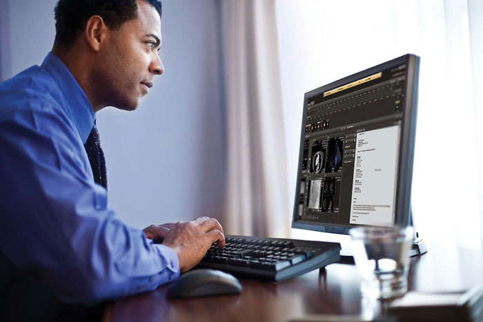 IntelliSpace Cardiovascular unterstützt schnelle und genaue Diagnosestellung