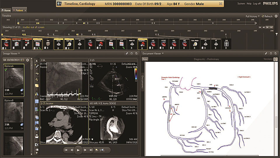 User Interface von IntelliSpace Cardiovascular