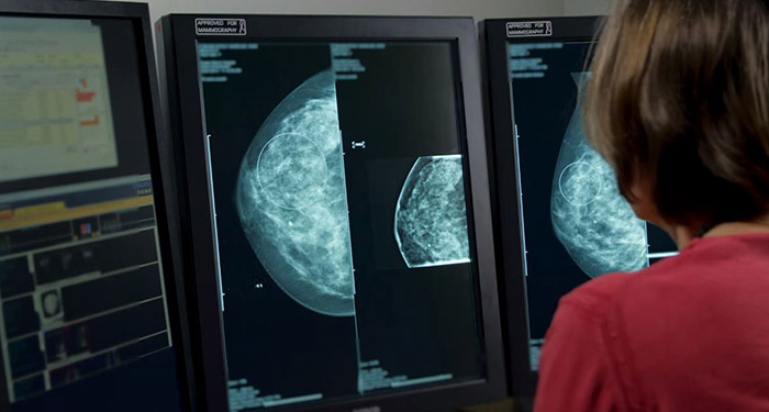 Video &uuml;ber die Umwandlung eines PACS-Arbeitsplatzes in einen Mammographie-Arbeitsplatz