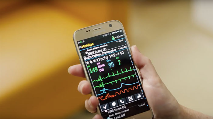 Verwendung mobiler Ger&auml;te zur Verwaltung von &Uuml;berwachungsalarmen mit Philips CareEvent Video