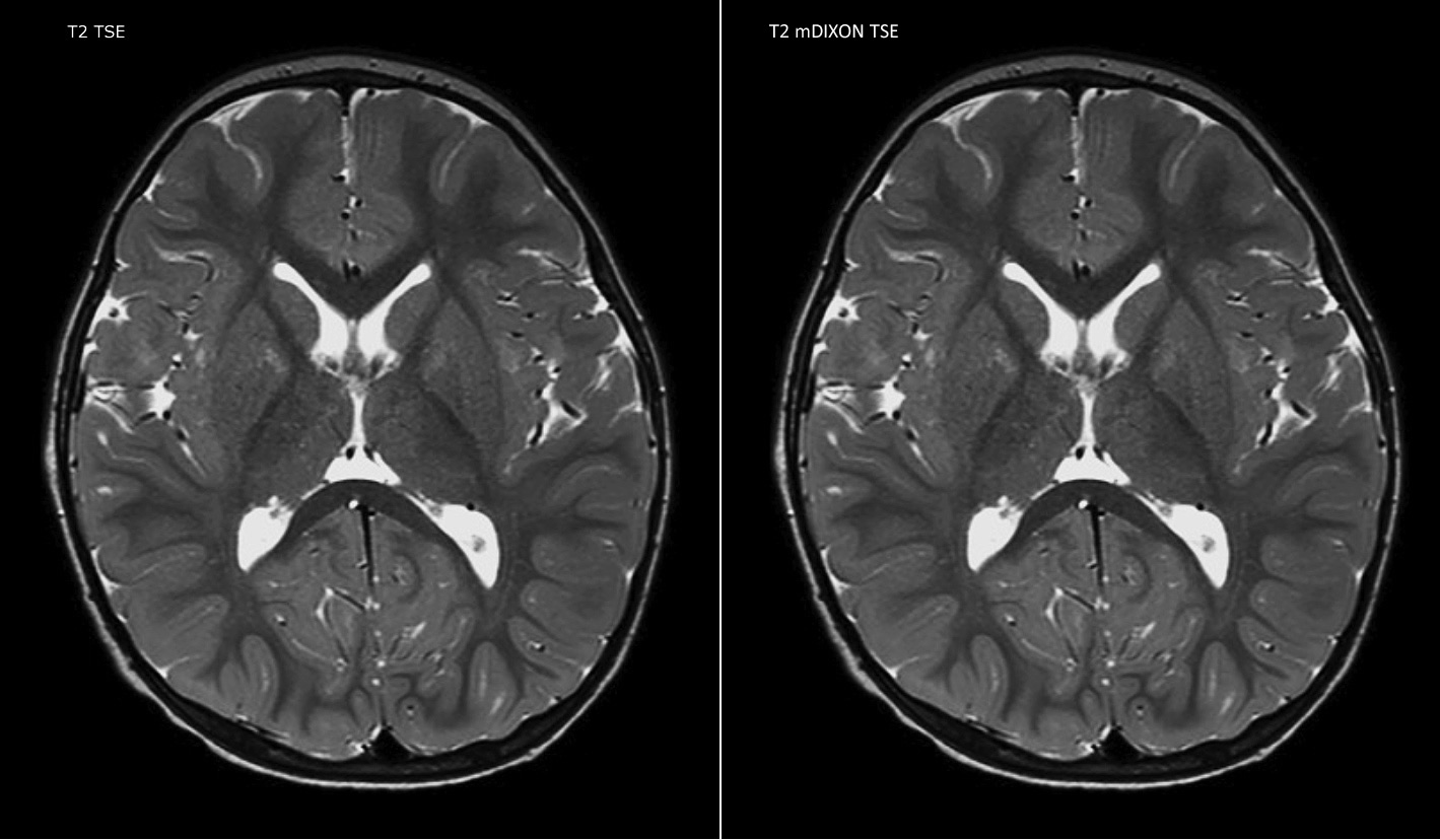 eine Nahaufnahme eines Gehirnscans