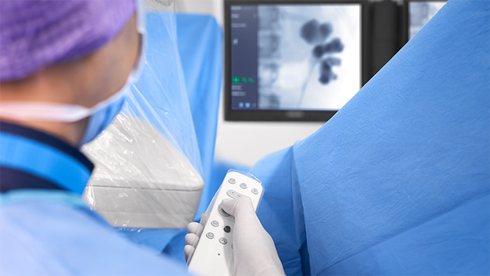 Mobile C-Bögen für die Gastroenterologie/Urologie