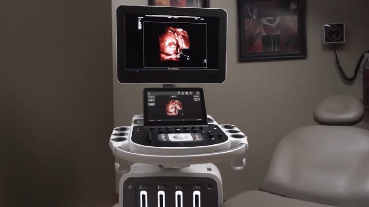 Dr. Michael Ruma stellt die Philips Ultraschallanwendungen TrueVue&nbsp;Pro, TouchVue, MPR&nbsp;Touch, Touch&nbsp;Sculpt, Touch&nbsp;Erase, Touch&nbsp;Zoom und aReveal vor