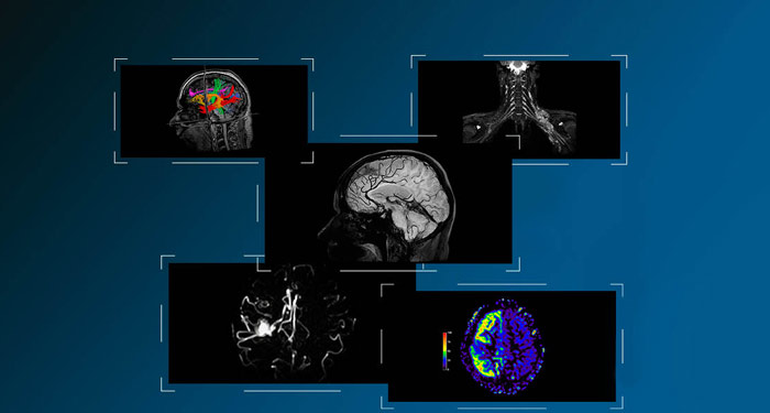 MR Neuro Imaging 