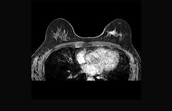 Mammal&auml;sion image