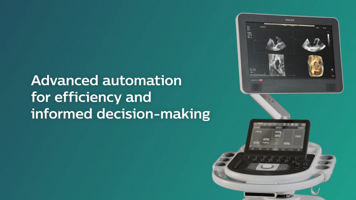 Video Vorstellung Philips Affiniti CVx f&uuml;r die kardiologische Routinediagnostik
