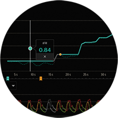 IntraSight iFR
